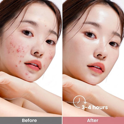 Bio-Collagen Face Mask